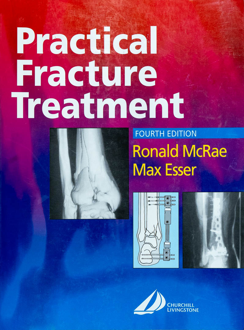 Practical Fracture Treatment - Ronald McRae